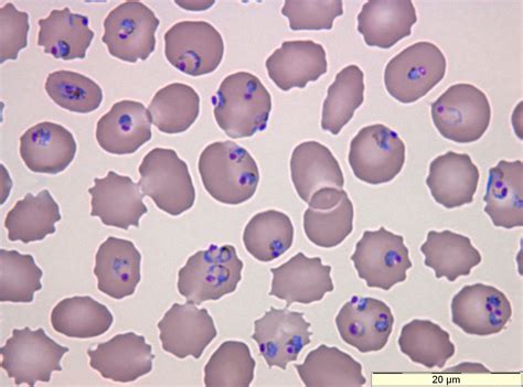 Plasmodium! A Microscopic Mastermind Capable of Unleashing Malaria's Fury Upon Its Unsuspecting Host