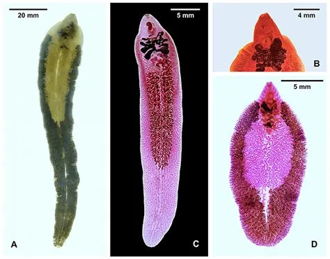  Fasciola hepatica – A Trematode Known for Its Love of Liver!