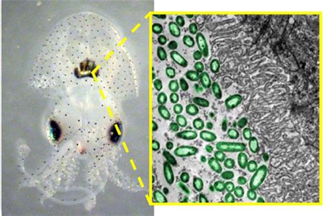  Vibrio! Kuka Se On Ja Miksi Se Yksisellinen Lentoliikkuja Kiinnostuisi Meitä?